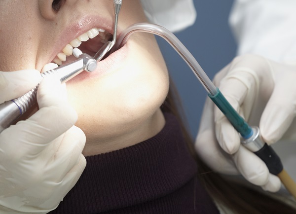close up of open mouth during dentist checkup