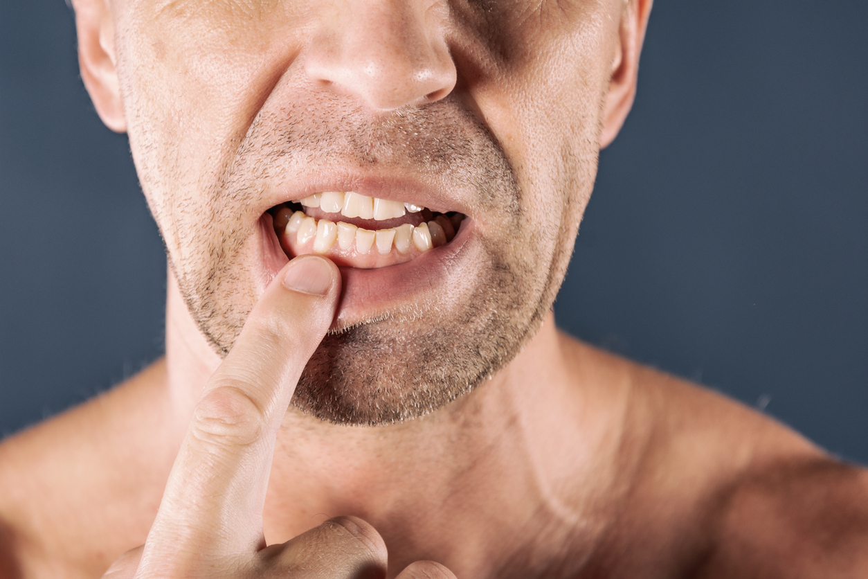 Sad depressed man in pain holding his gum. Portrait of a man on blue background. emotion facial expression. Feelings and people reaction. Toothache