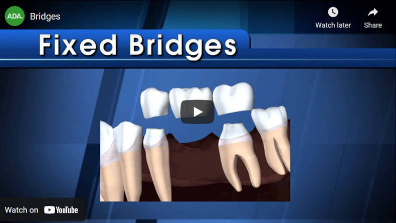 Bridges
