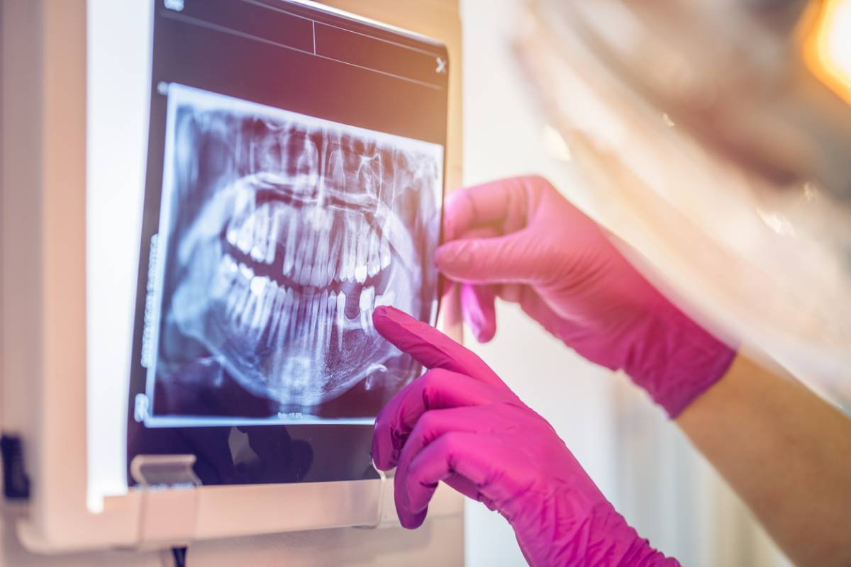 Dentist pointing to dental x-rays