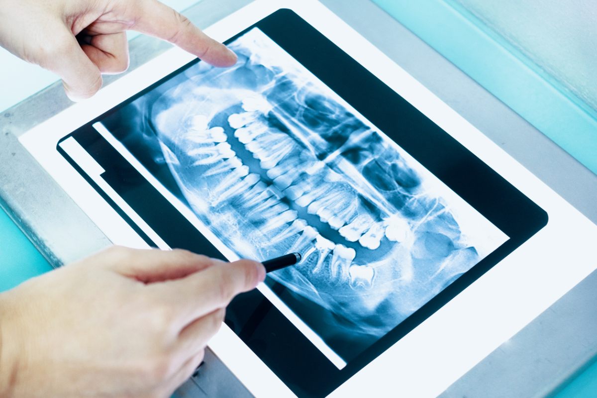 concept of how many dental x-rays are safe per year